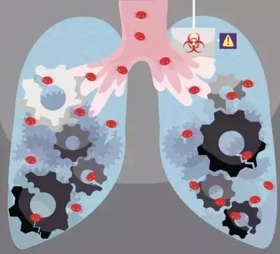 肺癌.jpg