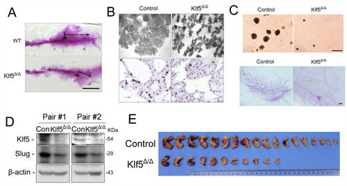 昆明动物所发现转录因子KLF5参与小鼠乳腺干细胞