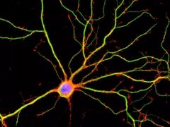 新研究发现神经发育相关基因缺陷