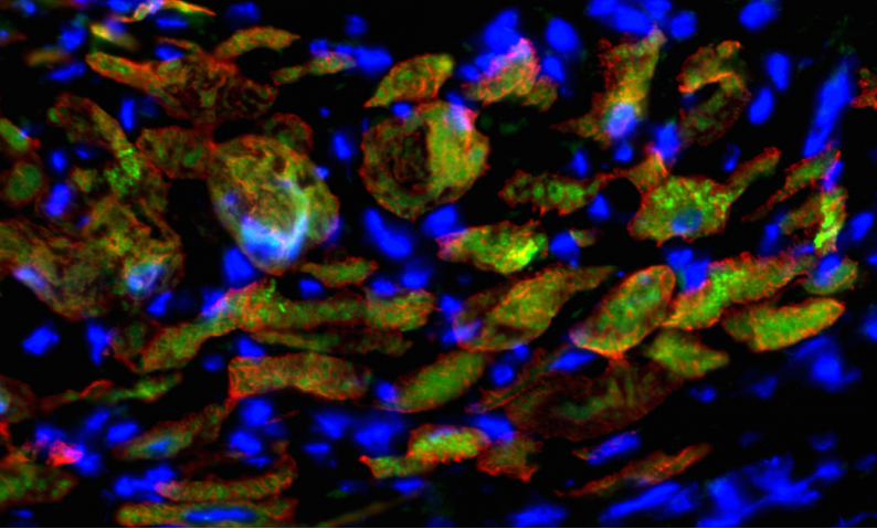 Cell Stem Cell：科学家将成纤维细胞成功重编程形成心脏祖细胞