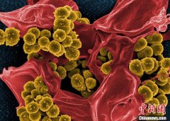 中科院微生物所科普：抗生素为何不能抗病毒