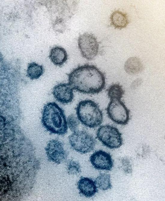 新冠病毒电镜图像公布：“高清彩照”下的新冠病毒长啥样？ 
