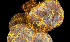 NatCellBiol：乳腺中发现新型免疫细胞，可以重塑乳房，防止乳腺癌！