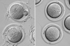 新型开关蛋白可打开精子进行受精