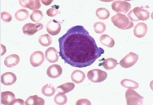 介绍下红细胞系统中晚幼红细胞的超微结构是什么