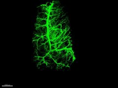 神经元如何重塑体内脂肪以提高其卡路里燃烧能力