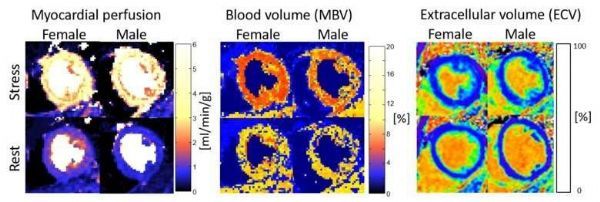 SciRep：研究揭示心脏生理学存在的性别差异!