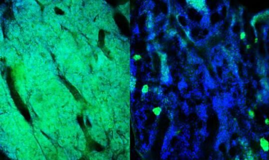 CellMetabol：突破！科学家或有望靶向作用细胞的代谢改变来清除耐药性癌细胞！