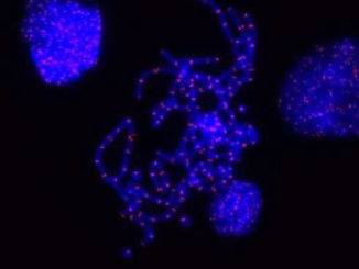 研究人员发现干细胞保护其染色体末端的独特方法