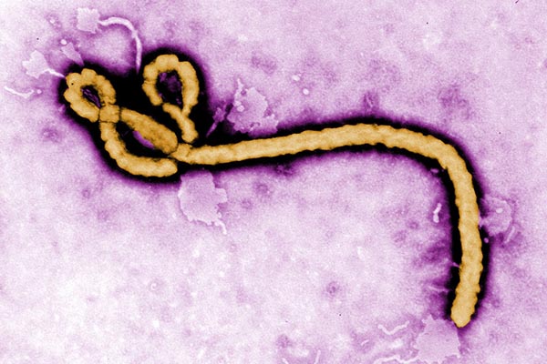 苏州完成埃博拉病毒关键基因合成，防治疫情第