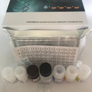 猪非红细胞血影蛋白β4 (SPTβN4)双赢生物ELISA试剂盒