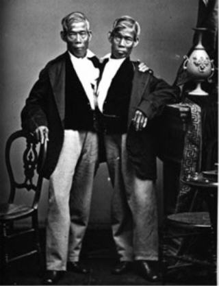 世界最著名连体人“暹罗双胞胎”照片：恩（Eng）和昌（Chang）