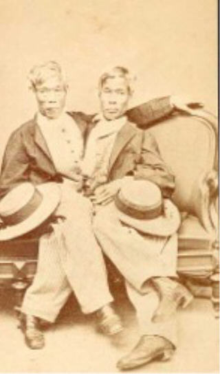 世界最著名连体人“暹罗双胞胎”照片：恩（Eng）和昌（Chang）