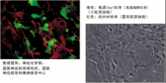 巨噬细胞/小胶质细胞Iba1抗体