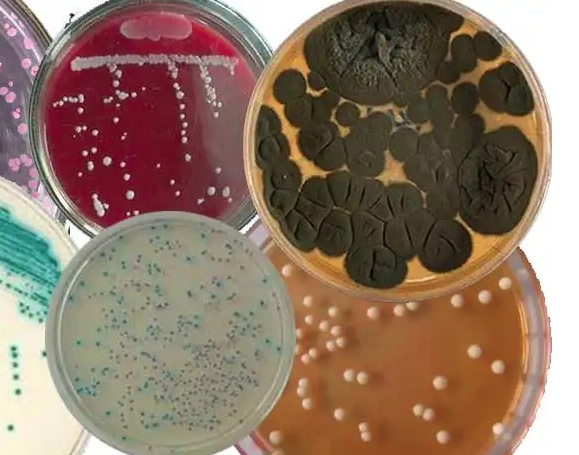 微生物培养基的主要成分有哪些