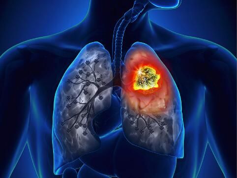 CellRep：支链氨基酸的代谢重编程作用或能促进肺癌药物耐受性的发生