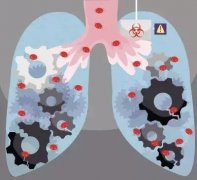 中国肺癌新亚型治疗研究取得成果