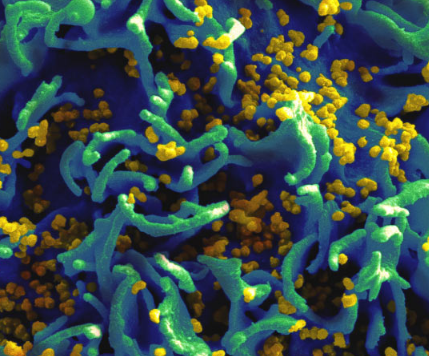 新鉴定的抗体可中和98％的HIV株