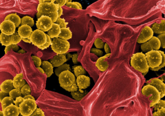 独特的抗生素组合杀死耐甲氧西林的金黄色葡萄