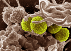 化学家合成了两种简化形式的杀死超级细菌的抗