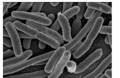 研究呼吁在胶囊化粪便移植物中筛选抗药性大肠