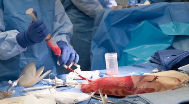 骨髓移植后，男人的身体正被捐献者的DNA“吞噬