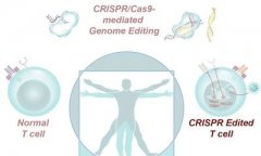 Science：CRISPR-Cas9编辑CAR-T细胞疗法可由于治疗难治性癌症