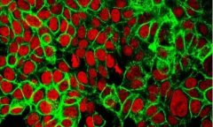 科学家开发出新型肠癌模型或有望揭示癌细胞如何对免疫疗法药物产生耐受性！