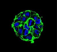 APLBioengin：科学家有望成功实现扩张机体自身的免疫系统杀灭癌细胞的能力