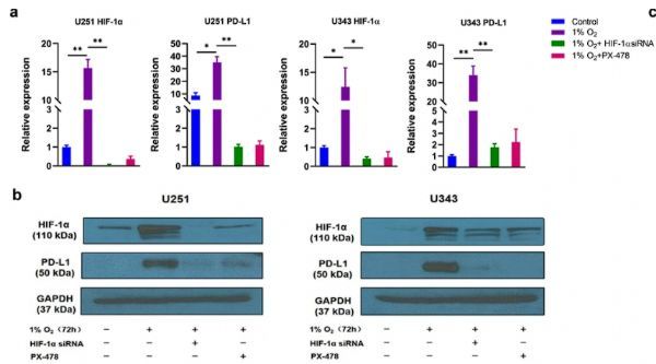 JHematolOncol：揭秘缺氧条件下胶质瘤细胞中PD-L1与HIF-1α表达的关系！