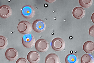 “纳米瓶”技术可按功能进行单细胞分类，对药