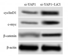 catenin信号通路影响胃癌BGC823细胞的凋亡